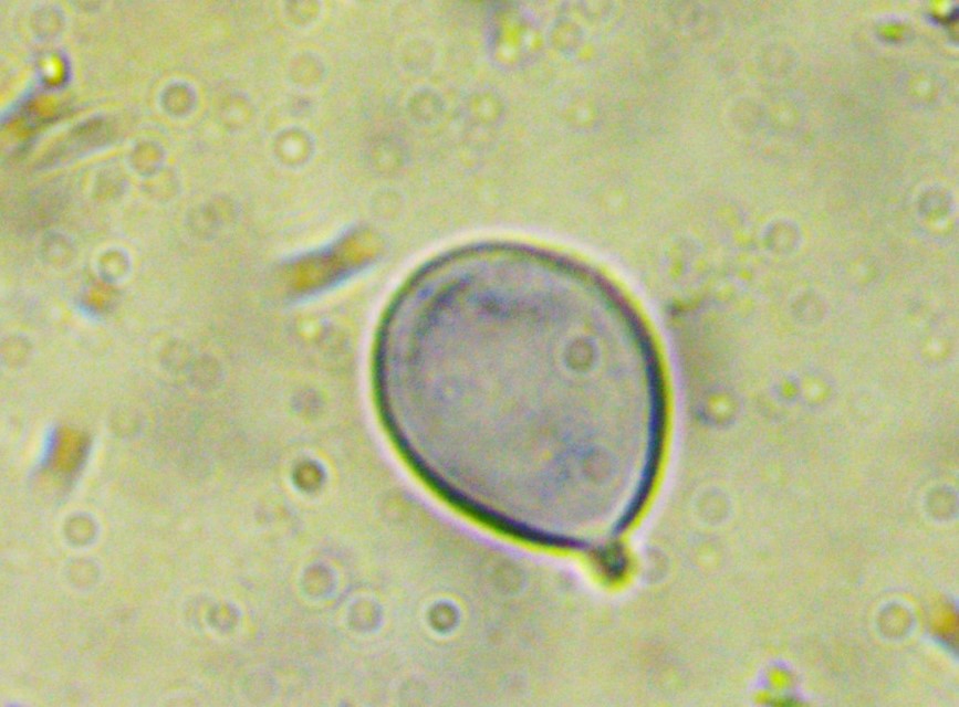Aleurocystidiellum subcruentatum 7 Spore amyloid Apikulus Appendix Sterigma 4 sporig Basidien glatt wirkend Exkursionsreise Krieglsteiner PIlzschule DGfM