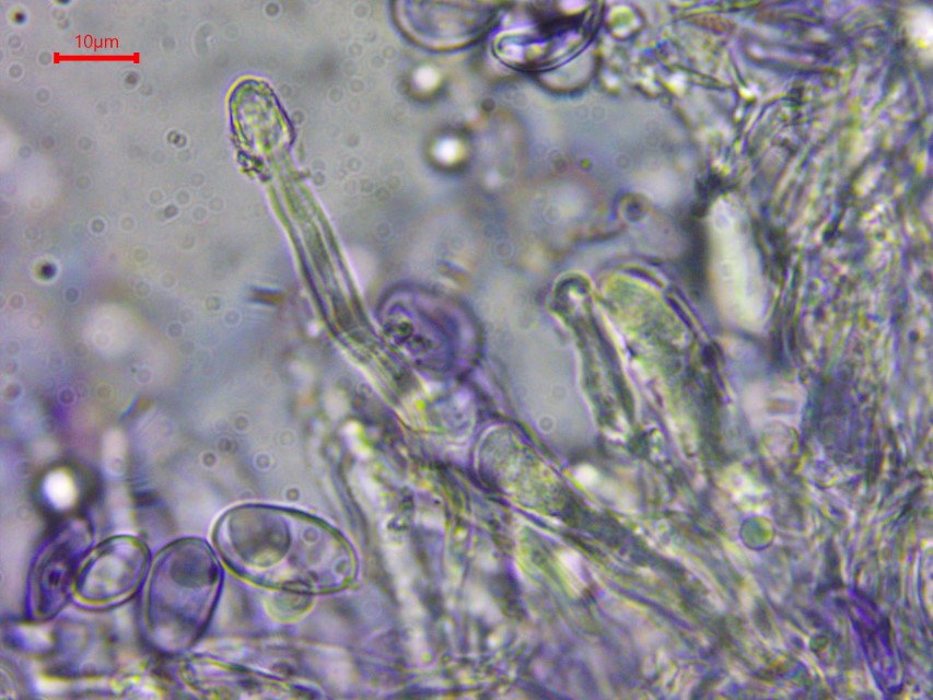 Aleurocystidiellum subcruentatum 9 Skeletozystiden inkrustiert Sporen amyloid Melzers Reagens Krieglsteiner Mikroskopierkurs Feldmykologe subalpin Tatra