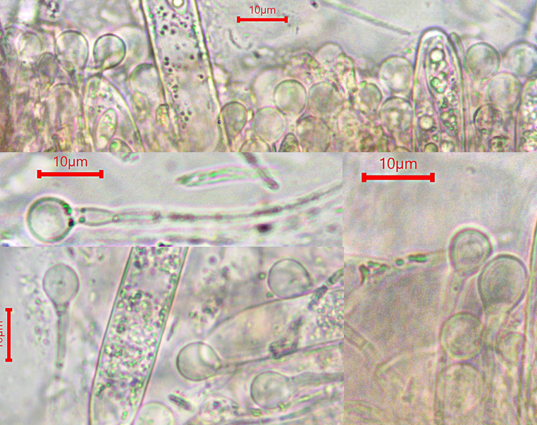 Ascocoryne inflata 3 Ballonsporiger Gallertbecherling Baral ined unbeschriebene Art Krieglsteiner Pilzkurs PIlzseminar Kocher Apothezien Haupfruchtform Nebenfruchtform Teleomorphe Anamorphe