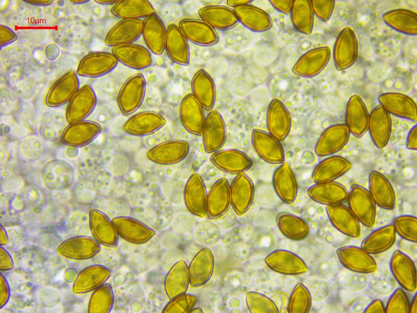 Hemistropharia albocrenulata 6 Sporen spindelig gross Keimporus innere Wand Pigment Apikulus Nordschweiz Weinfelden Pilzkurse Pilzschule Krieglsteiner