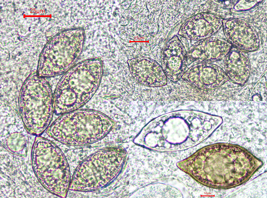 Leucangium carthusianum 4 Picoa carthusiana schwarze Trueffel Krieglsteiner Pilzkurse Pilzseminare Pilzschule Feldmykologe PSV DGfM Sporen reif unreif zitronfoermig Guttulen Deutsdhland