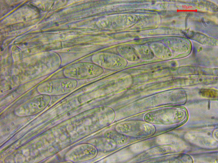Monilinia baccarum 15 Asci 8 sporig oben 4 kleine unten 4 grosse Sporen Paraphysen Hymenium Schlauchpilze Ascomyceten Mikroskopie inoperculate Becherlinge Pilz Custom