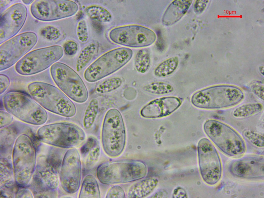 Monilinia baccarum 17 Sporen frei grosse kleine Tropfenmuster guttulat Ascomycetes Ascomycota Schlauchpilze inoperculate Becherlinge Pezizomycotina Helotiales Leotia Custom