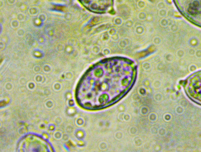 Aleurocystidiellum subcruentatum 6 Sporen amyloid ornamentiert Latschenkiefer PInus mugo uncinata Spirke subalpin Slowakei Pilzschule Schwaebischer Wald