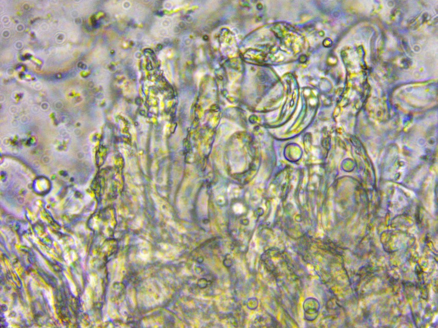 Aleurocystidiellum subcruentatum 8 Skeletozystiden dickwandig Stack BMS inkrustiert Slowakei Exkursionsreise Pilzschule Schwaebischer Wald Krieglsteiner