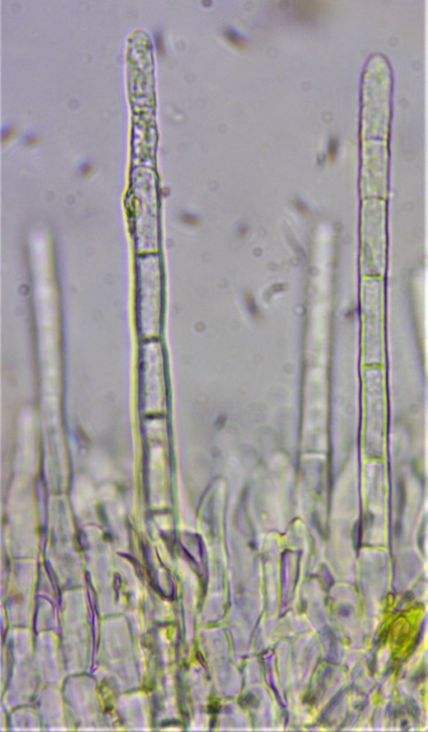 Arachnopeziza obtusipila 7 Stumpfhaariges Spinnwebbecherchen Arachnoepzizaceae Hyaloscyphaceae Exzipulum Sporen Asci Paraphysen septiert Krieglsteiner