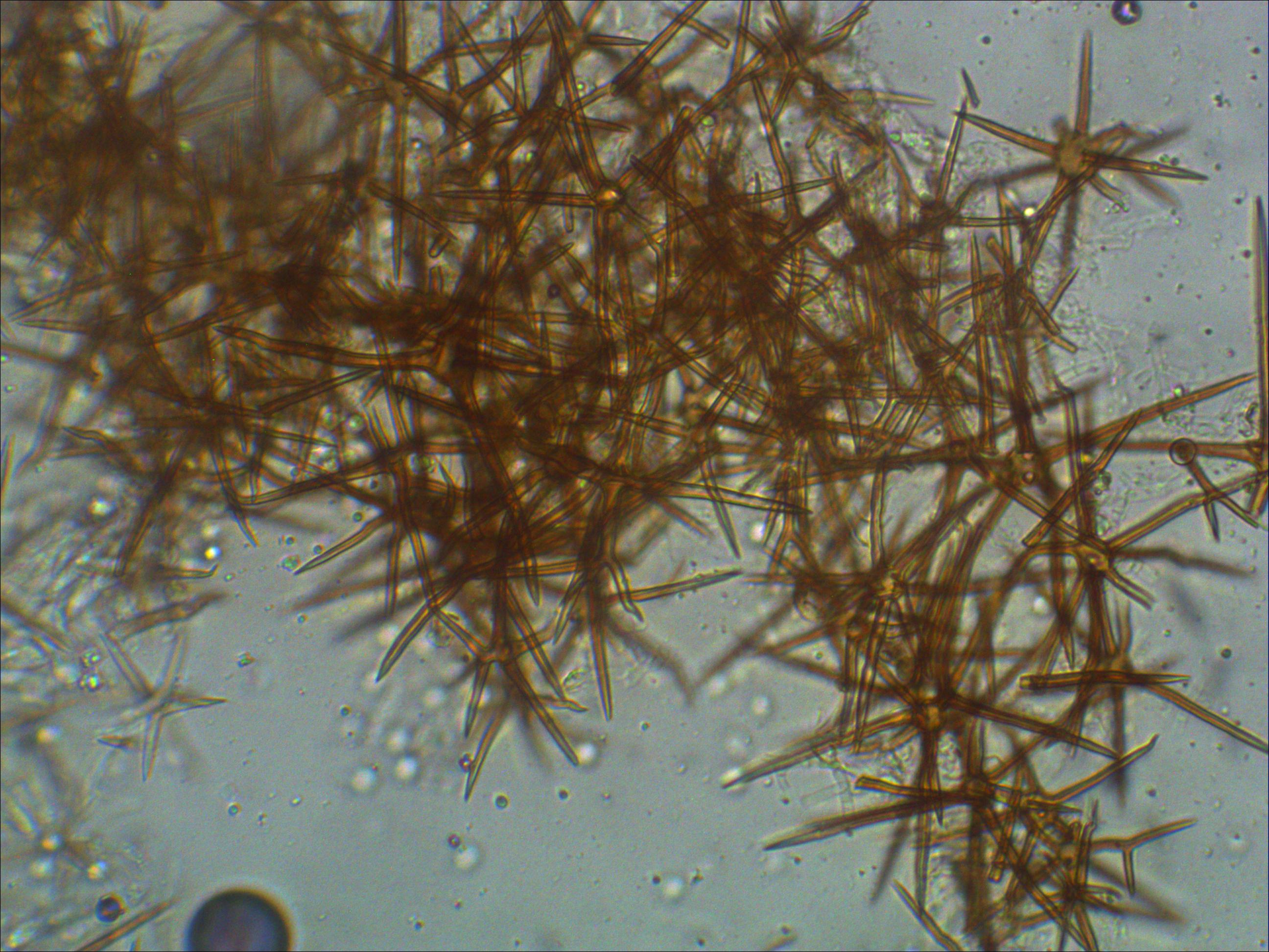 Asterostroma cervicolor Asterosetae Urwald Tschechien Rindenpilz Mikroskopie Pilzschule Schwaebischer Wald