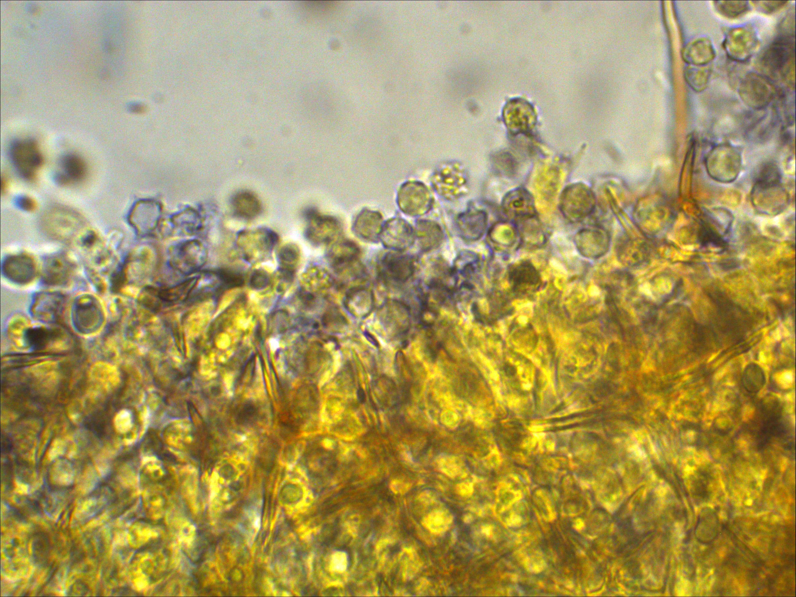 Asterostroma cervicolor ochroleucum medium Rindenpilz Asterosetae Sporen amyloid ornamentiert Mikroskopie