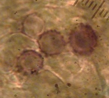 Bondarzewia-mesenterica-Sporen-amyloid-Schwäbischer-Wald