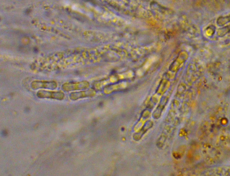 Bryocentria-brongniartii-Pustelpilz-Frullania-dilatata-Wassersack-Lebermoos-Sporen-hantelfoermig-Hundeknochen-Pustelpilz-Mikroskopierkurs-Pilzseminar-Baden-Wuerttemberg 800x611