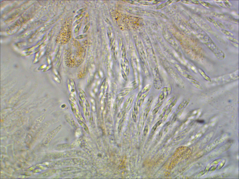 Bryocentria-metzgeriae-Pustelpilz-Radula-complanata-Kratz-Lebermoos-Sporen-spindelfoermig-Wandverdickung-Mikroskopierkurs-Artenvielfalt 800x600