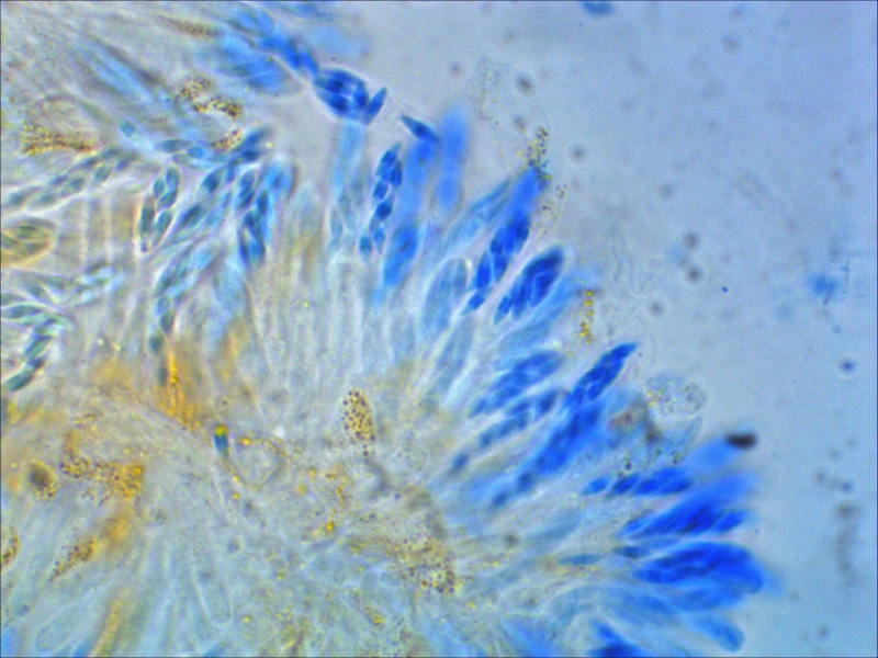 Bryocentria-metzgeriae-Pustelpilz-Radula-complanata-Kratz-Lebermoos-Sporen-spindelfoermig-cyanophil-Wandverdickung-Mikroskopierkurs-Pilzseminar-Baden-Wuerttemberg-Welzheim-Baumwollblau 800x600