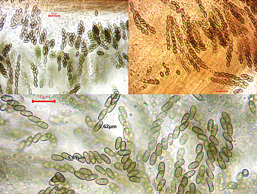 Camarops polysperma 5 Ascomycet Asci 8 sporig inamyloid ohne Keimspalt klein Urwaldart Alnus glutinosa Laubholz Ostwuerttemberg Schwaebisch Gmuend Albvorland Pilzkurse