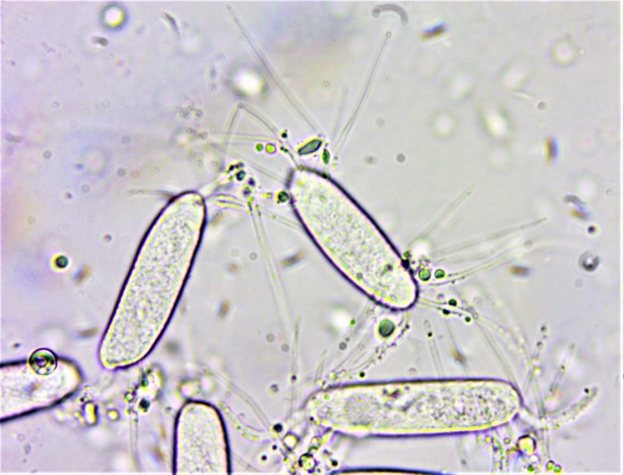 Chaetospermum chaetosporum Sebacinales Endomykorrhiza Loewenzahn Taraxacum Ruderalia Spraitbach Mikroskpierkurs Brunnenlebermoos Marchantia polymorpha Kroatien Sammelart Konidien Anhaengsel