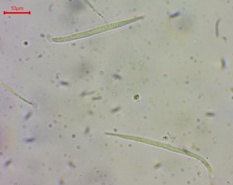 Colpoma crispum 10 Sporen abgerundet zugespitzt einseitig Rhytismatales Runzelschorf Ascomycet Schlauchpilz Schildbecherling Krieglsteiner Mikroskopierkurs Feldmykolog