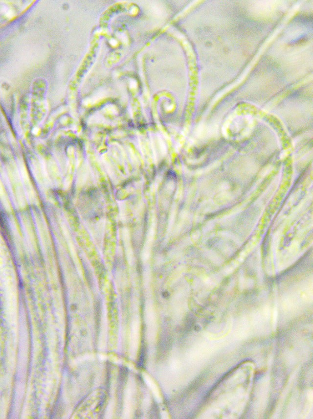 Colpoma crispum 11 Paraphysen guttulat Tropfen lebend Merkmal Vital Taxonomie Baral verzweigt knorrig gebogen haploid Mikroskopierkurs Krieglsteiner Pilzschule