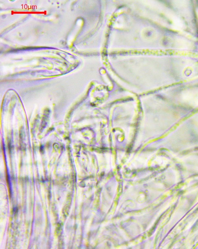 Colpoma crispum 12 Paraphysen Pilzschule Schwaebischer Wald Mikroskopierkurs Feldmykologe Vitaltaxonomie Krieglsteiner Lothar Katharina Hohe Tatra Slowakei