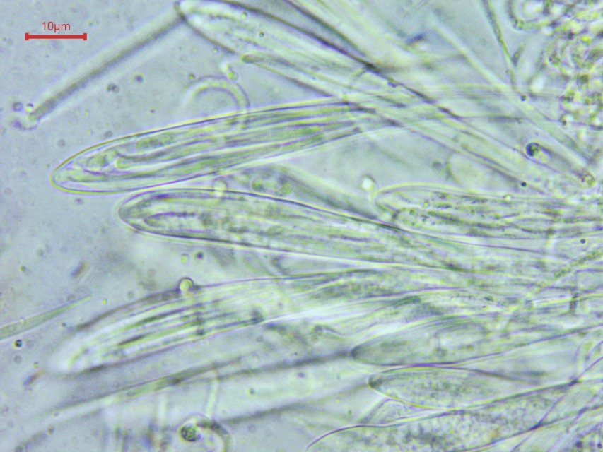 Colpoma crispum 6 Asci Sporen parallel 8 Ascomycet Schlauchpilz Hohe Tatra Slowakei Rhytismatales Pilzschule Pilzkurse Seminare Krieglsteiner Mikroskopierkurs