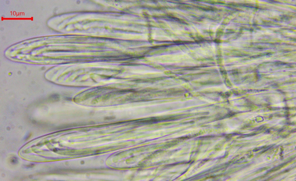 Colpoma crispum 7 Krause Zweig Spaltlippe Hohe Tatra Slowakei Nationalpark Latschengebuesch Pinus mugo subalpine Stufe Fichtenforst Skipisten Krieglsteiner Asci