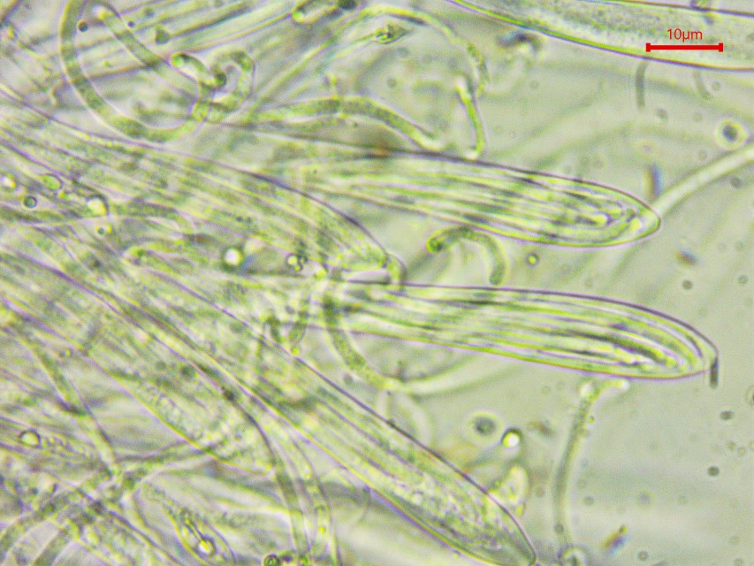 Colpoma crispum 8 Schlauchpilz Schildbecherling Krause Zweig Spaltlippe Rhytismatales Runzelschorf Lirellen Sporen parallel Ascus Mikroskopierkurs Feldmykologe