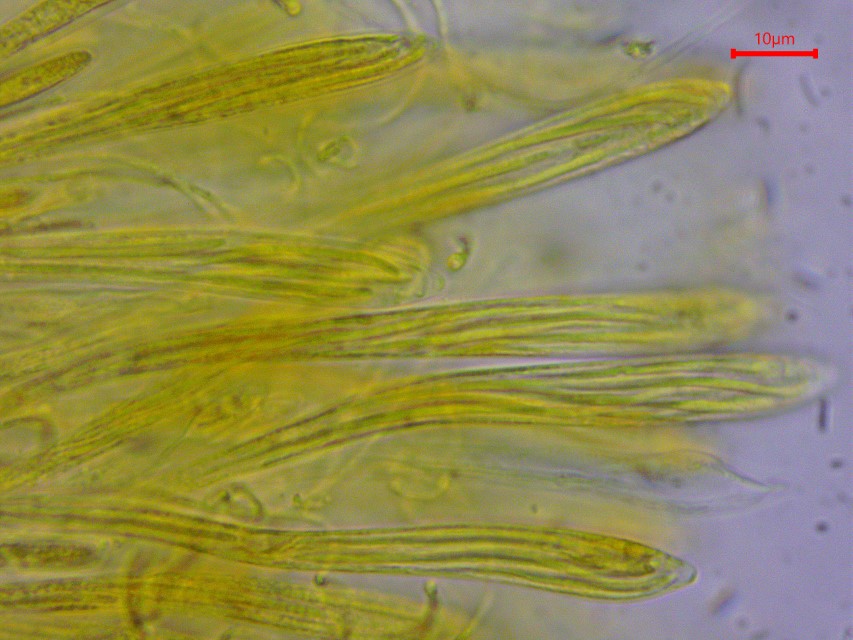 Colpoma crispum 9 Krause Zweig Spaltlippe Asci Jod inamyloid Baral Sporen parallel achtsporig jodnegativ Slowakei Nationalpark Hohe Tatra subalpine Stufe Latschenkiefe