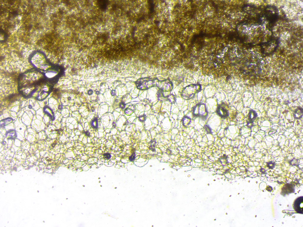 Coprinellus micaceus 94 Huthaut Hymeniderm Cystoderm Gschwend Baden Wuerttemberg Mikroskopierkurs Katharina Krieglsteiner Coprinopsis Parasola