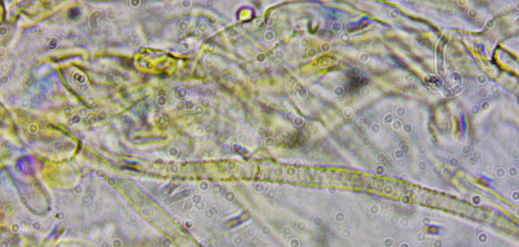 Cortinarius rufoallutus 10 Schnalle Pigment inkrustierend zebra spiral PIlzschule Deutschland Neuordnung Bestimmungsschluessel Sporengroesse Krieglsteiner Kurs