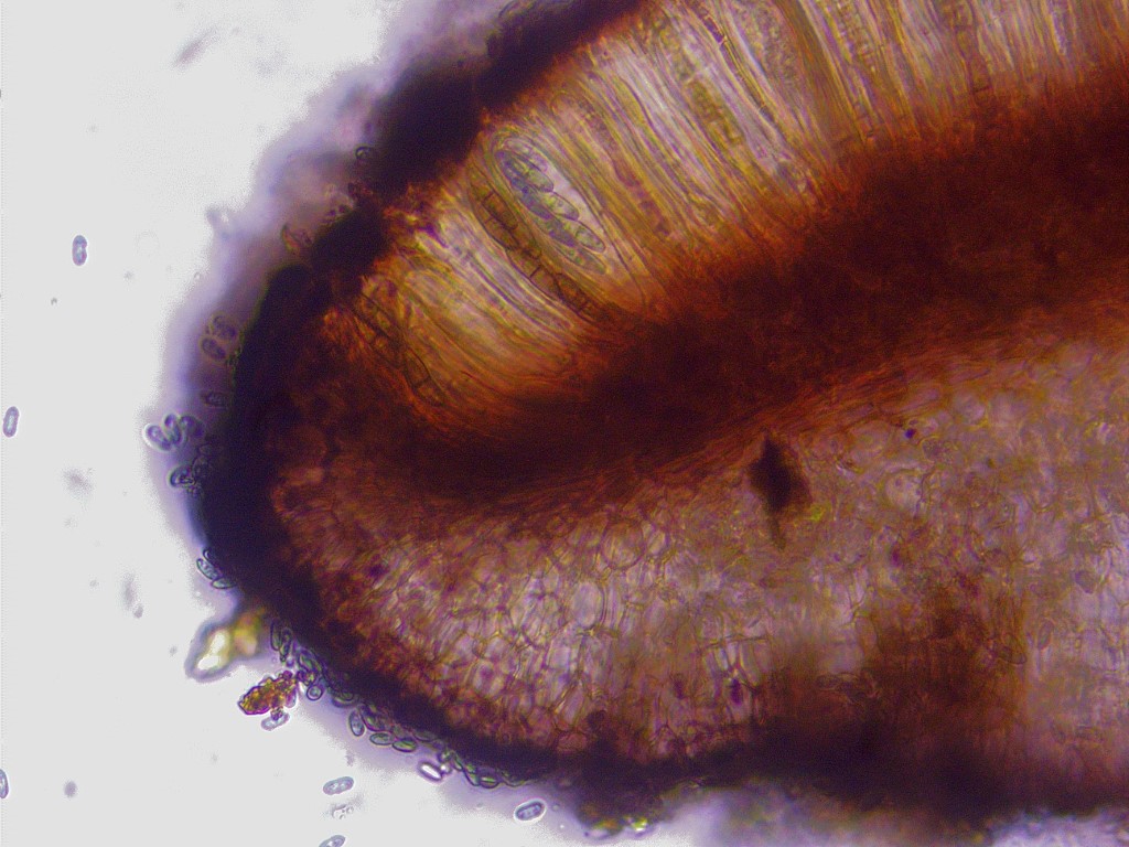 Dactylospora stygia 1 Schnitt Excipulum textura globulosa Hymenium Fruchtschicht Asci Epithecium Paraphysen Mittel