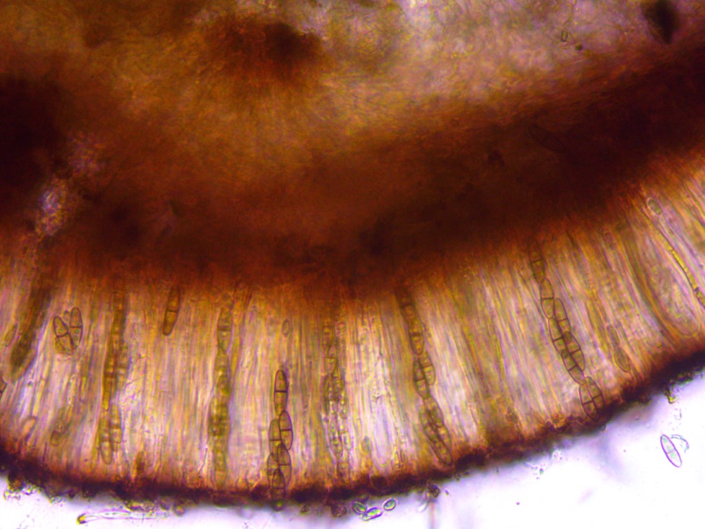 Dactylospora stygia 2 Schnitt Epithecium Paraphysen Sporen zweizellig Septen Asci Pilzkurse Mikroskopierkurs Pilzschule Schwaebischer Wald Mittel