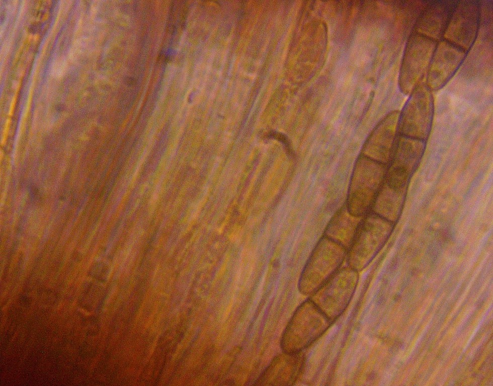 Dactylospora stygia 3 Sporen zweizellig Guttulen Vitaltaxonomie Auwald Rheintal Laubholz Mikroskopierkurs Baden Wuerttemberg Mittel
