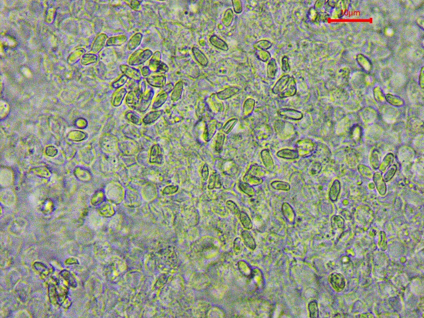 Echinoderma hystrix 7 Lepiota hystrix Sporen zylindrisch KOH Sporenpulver weiss Mikroskopierkurs Pilzschule Schwaebischer Wald Feldmykologe PSV