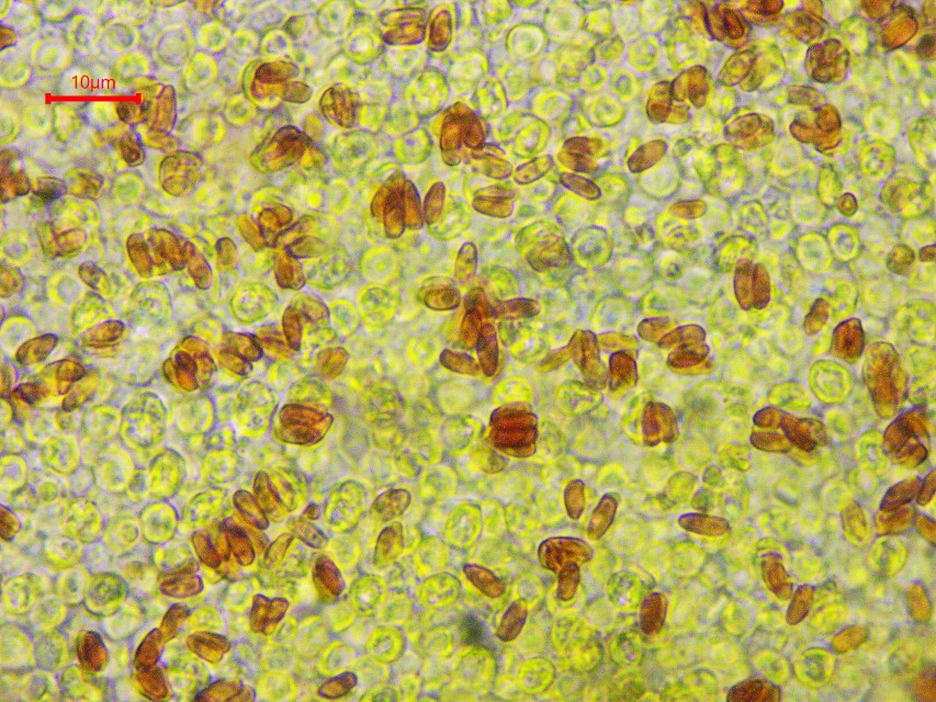 Echinoderma hystrix 8 Sporen dextrinoid Melzers Reagens rotbraun Mikroskopierkurs PSV Feldmykologe Stachelschwein Stachelschirmling Krieglsteiner Feldmykologe
