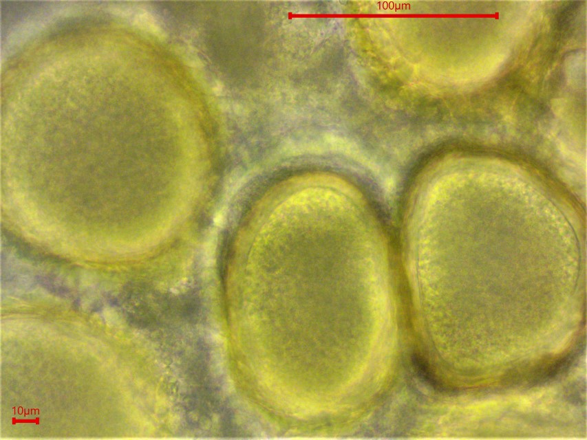 Endogone lactiflua Sporen glatt umwoben intricat Sporen gross natrueff Hoernicke Krieglsteiner PIlzschule Schwaebischer Wald Feldmykologe