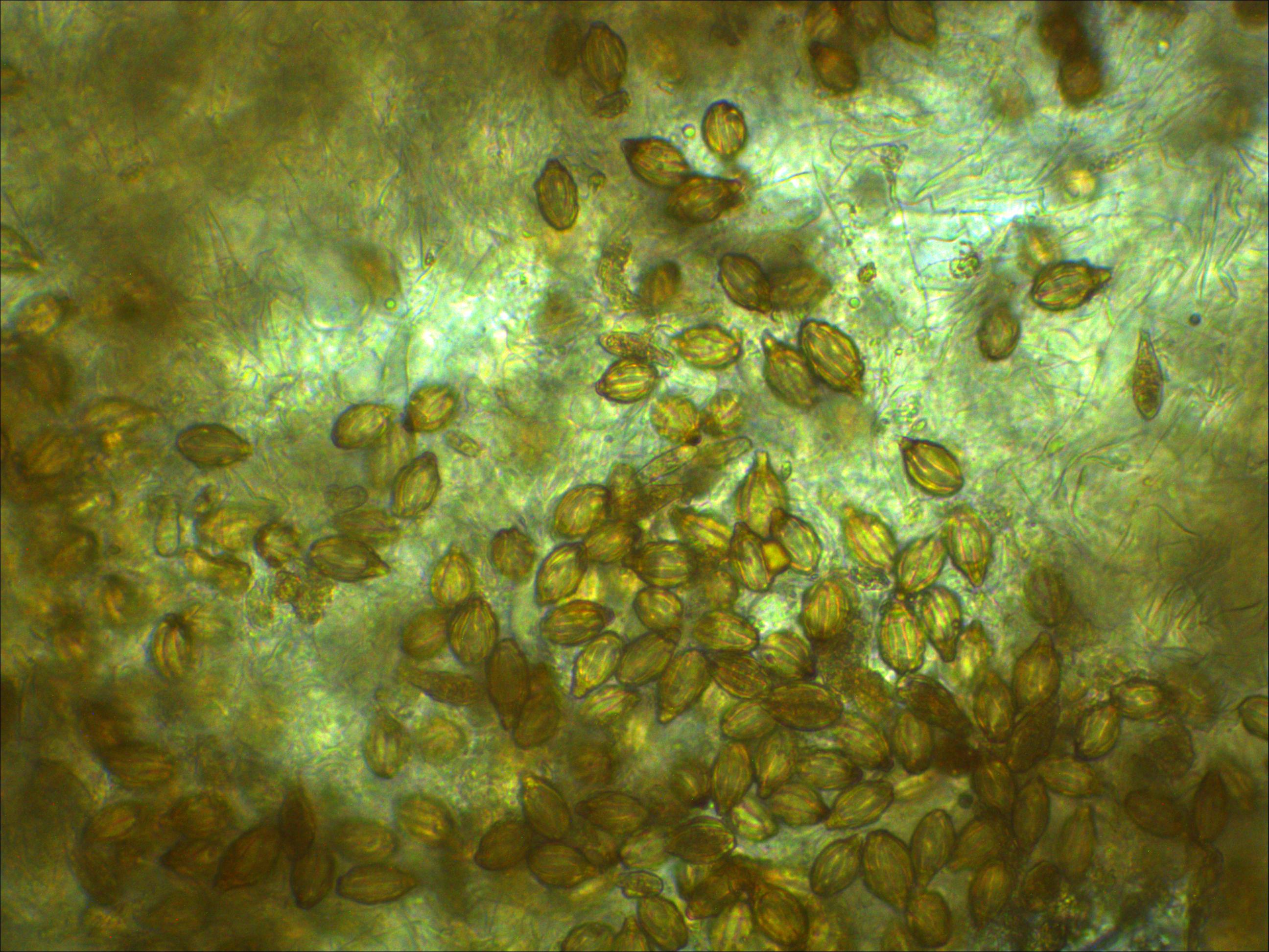 Gautieria graveolens Sporen kurz breit gerippt Schwaebischer Wald Stuttgart Gomphaceae Ramaria