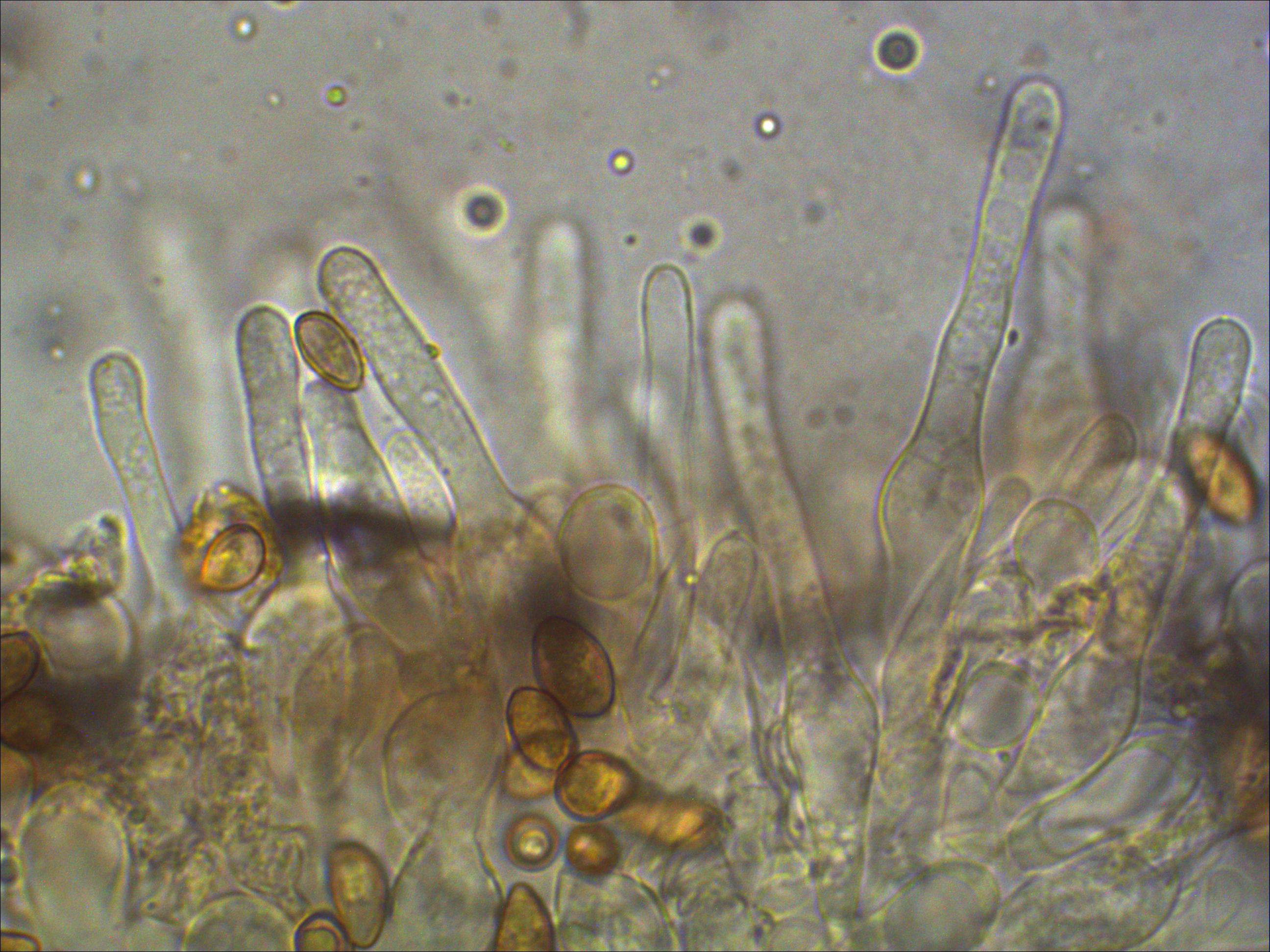 Hebeloma nigellum 3 Cheilozystiden Eifel Mykorrhiza Salicetum auritae Mikroskopierkurs Nordrhein Westfalen Nationalpark Krieglsteiner Feldmykologe PSV Ausbildung