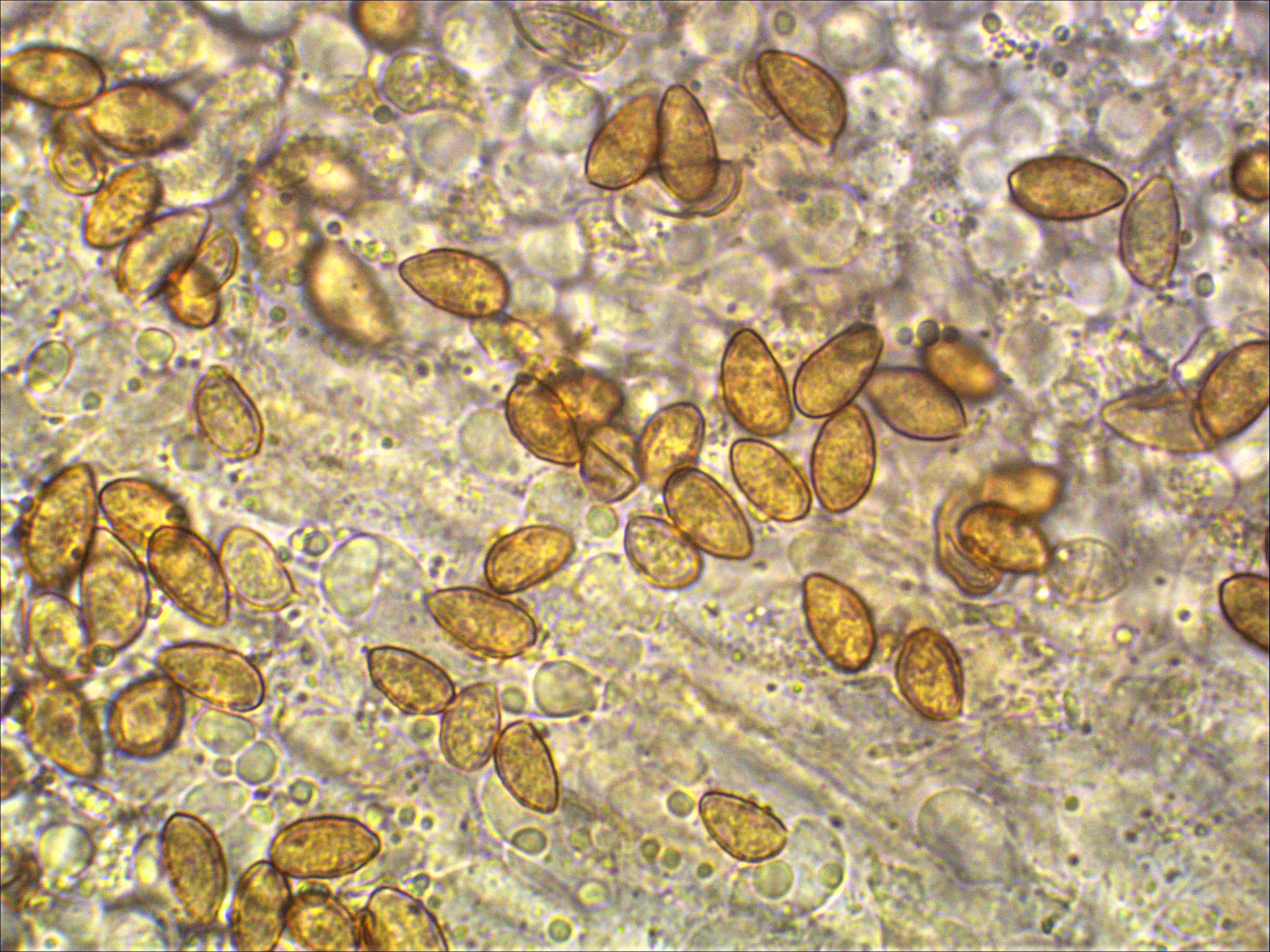 Hebeloma nigellum 4 Nationalpark Eifel Sporen ornamentiert Mikroskopierkurs Hymenogastraceae Mykorrhiza Ohrweide Salix aurita Braunsporer LBM Krieglsteiner Mykologie