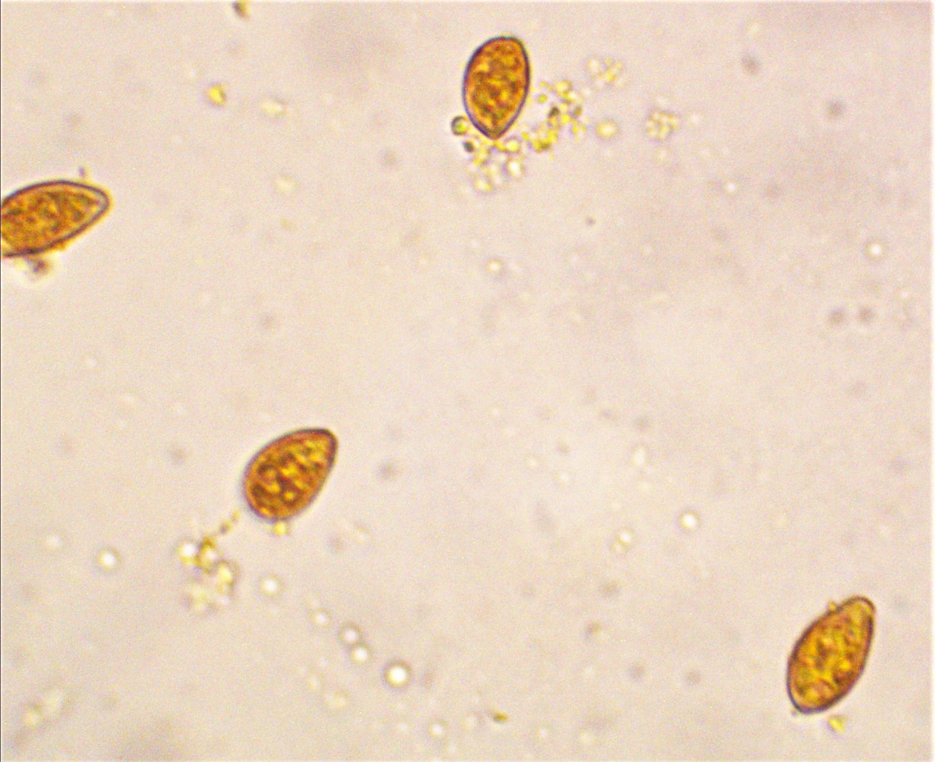 Hebeloma nigellum 5 Nationalpark Eifel Sporen Melzers Reagens dextrinoid Mikroskopierkurs Krieglsteiner Pilzschule Schwaebischer Wald Hebeloma mesophaeum