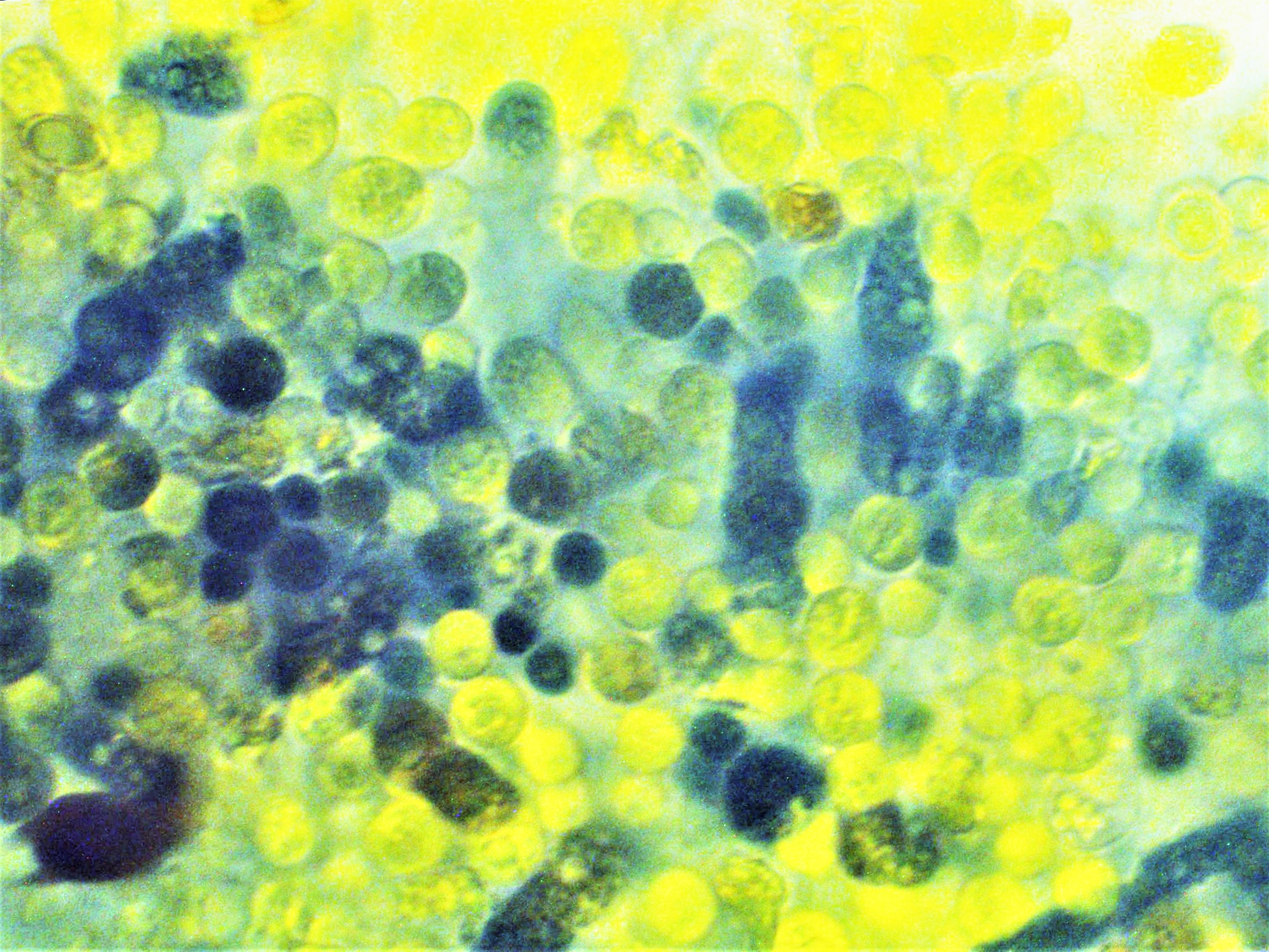 Hebeloma nigellum 8 mesophaeum Dunkelscheibiger Faelbling Italien Ligurien Basidien amyloid lebend vital Chloralhydrat toxisch letal Krieglsteiner Mikroskopierkurs