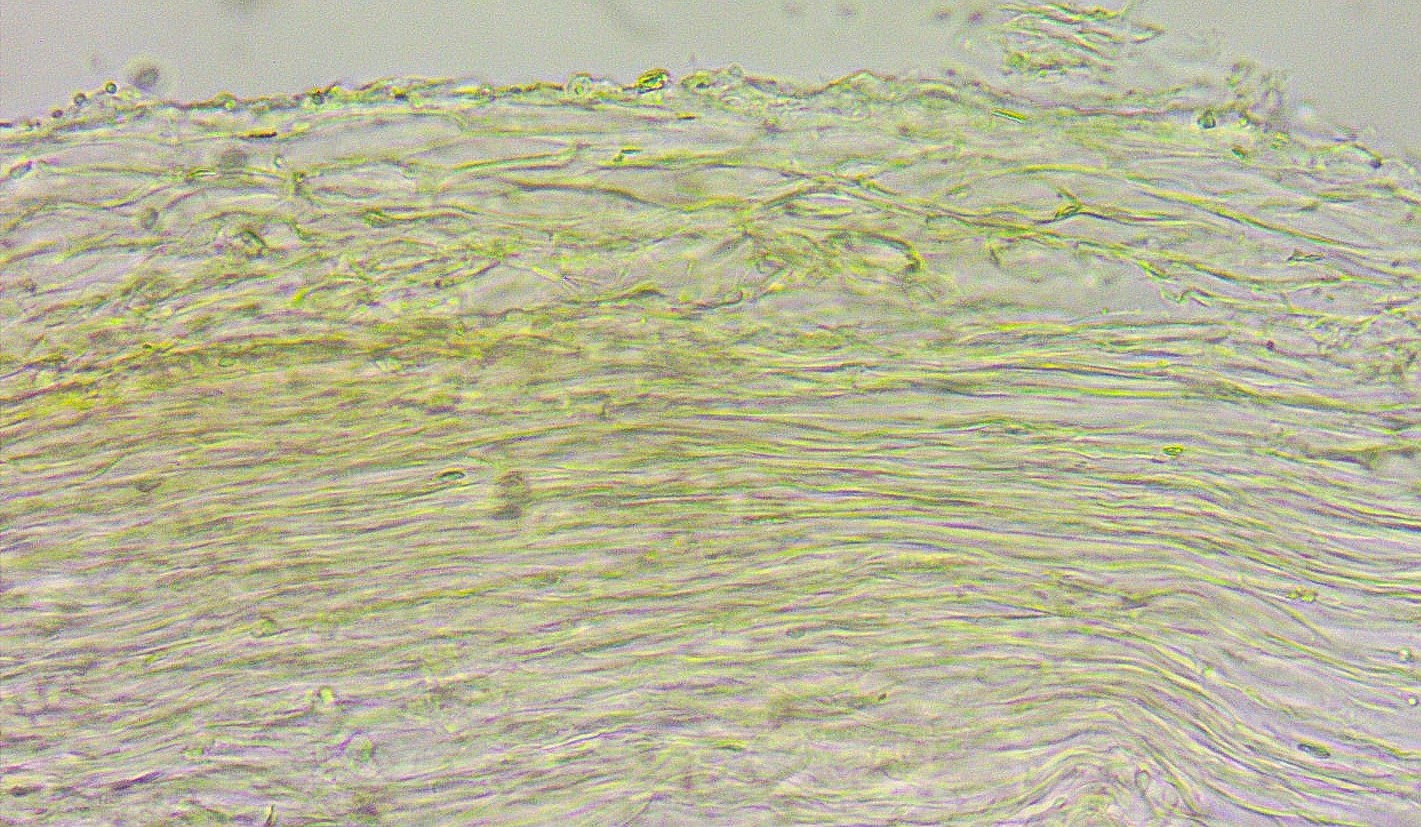 Hydropus pseudotenax 23 Kleinsporiger Wasserfuss Pileipellis Cutis kurze Auswuechse liegende Hyphen Radialschnitt Mikroskopierkurs Krieglsteiner