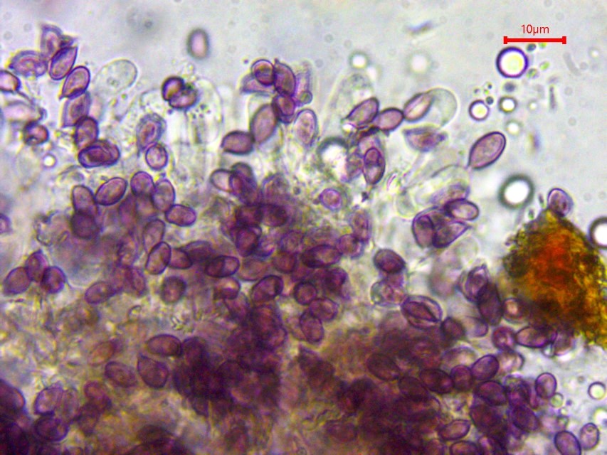 Hypochnella violacea 5 Sporen Basidien Staender viersporig ohne Schnallen Apikulus Krieglsteiner Portugal Algarve Loule Barrocal Kalkgebiet Krieglsteiner Pilzkurse
