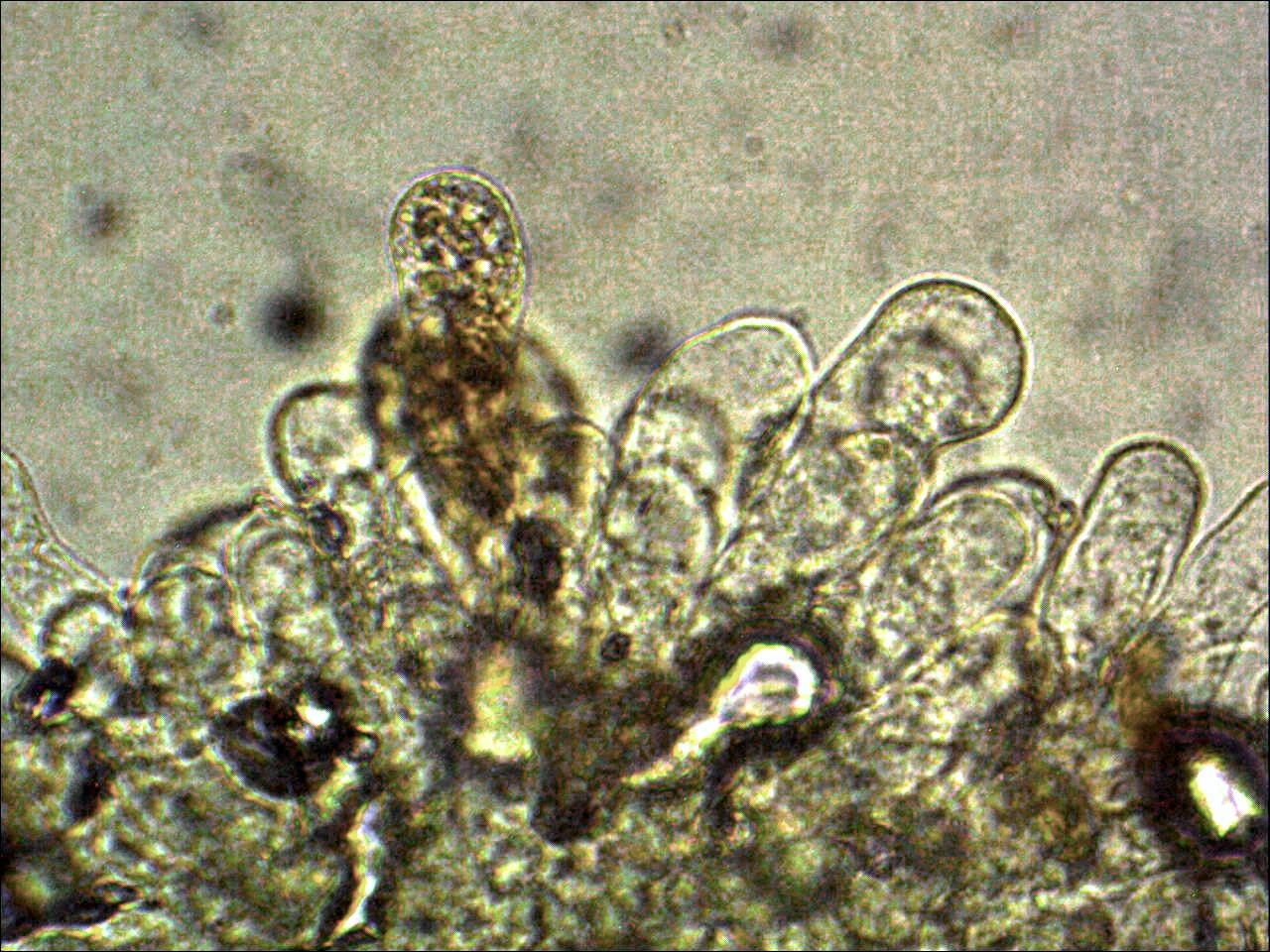 Inocybe-cervicolor-Cheilozystiden-Aspekt-Hirschbrauner-Risspilz-Muscarin-giftig