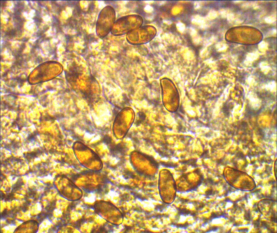 Inocybe-cervicolor-Sporen-Aspekt-Hirschbrauner-Risspilz-Muscarin-giftig