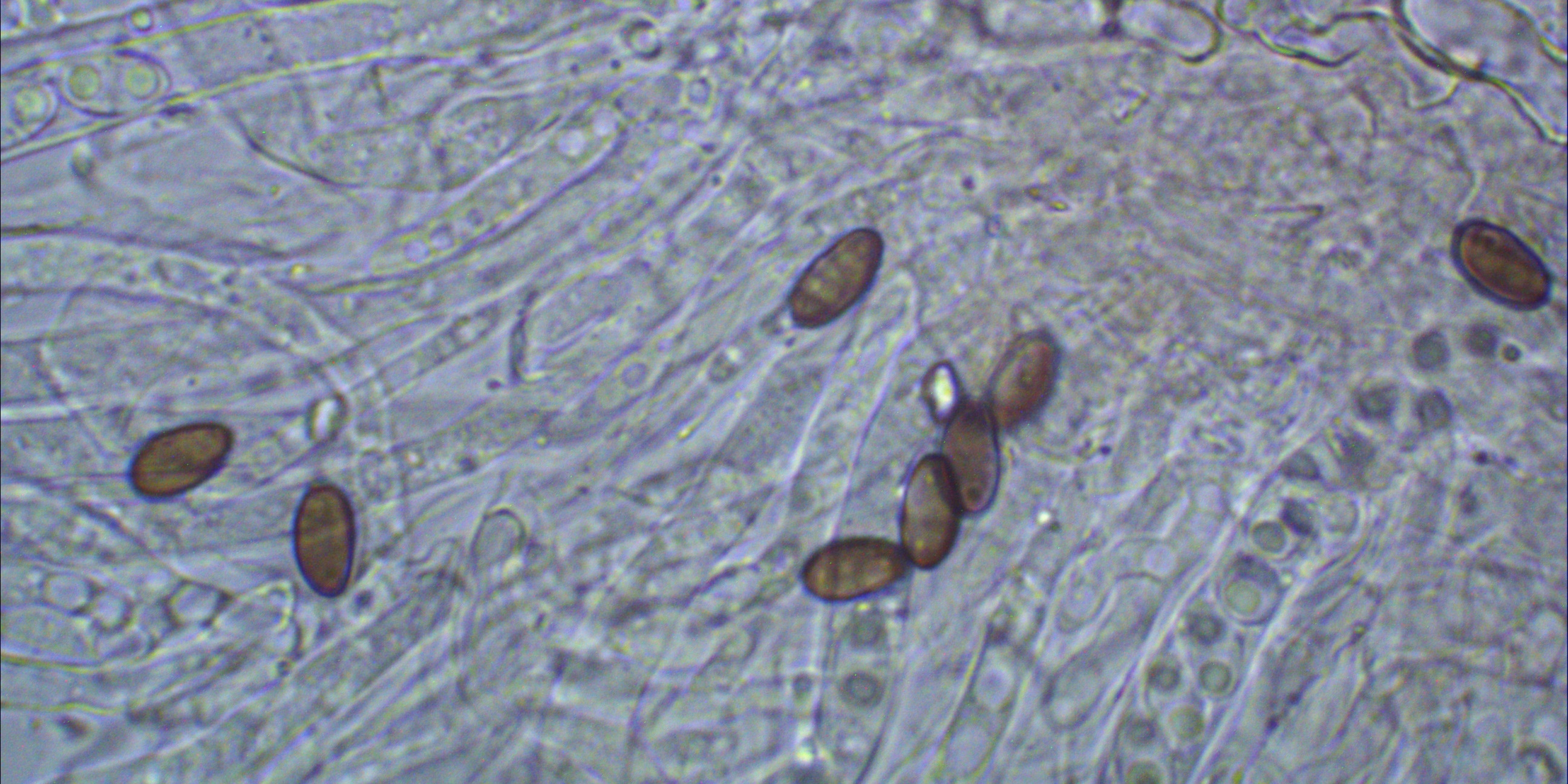 Lambertella corni maris reife Sporen gefaerbt selten Becherling Bestimmungskurs Mikroskop Fruehling
