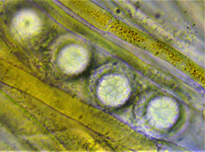 Lamprospora tortulae ruralis Dachdrehzahnmoos Moosbecherling Pyronemaceae Pezizales Tortula ruralis Spraitbach Feldmykologe Krieglsteiner PIlzschule Sporenornament Mikroskopierkurs Sporen Paraphysen