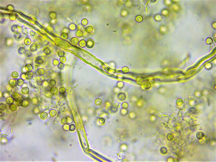 Lycoperdon norvegicum Norwegischer Stubling Schwbischer Wald Baden Wrttemberg Rotenhar Pilzschule Bauchpilzkurs Krieglsteiner Nadelwald Capillitium