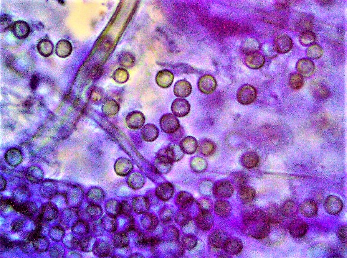 Lycoperdon norvegicum Norwegischer Stubling Schwbischer Wald Baden Wrttemberg Rotenhar Pilzschule Bauchpilzkurs Krieglsteiner Sporen fast glatt Baumwollblau