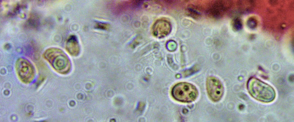 Lyophyllum brunneo ochrascens 11 semitale Ockerbrauner Rasling hygrophaner Sporen ellipsoidisch supraapikale Depression Oeltropfen Mikroskopierkurs