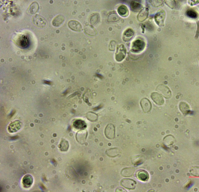 Lyophyllum brunneo ochrascens 12 KOH Sporen tot inhaltsleer ellipsoidisch dickwandig Krieglsteiner Mikroskopierkuirs Herausforderung hytter Norwegen