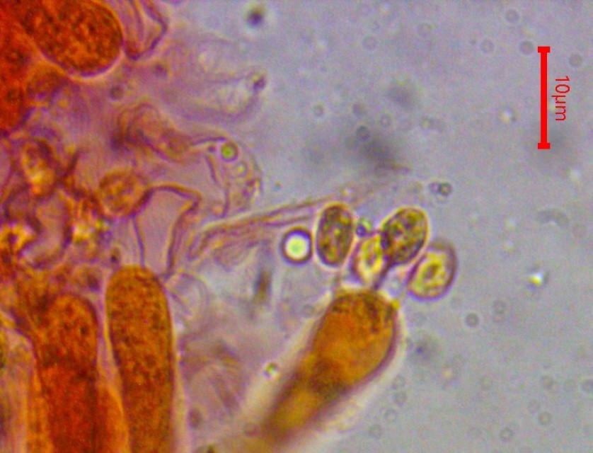 Lyophyllum brunneo ochrascens 14 Basidien viersporig Kongorot Sterigmen Mikroskopie Erhard Ludwig Ockerblaettriger Rasling siderophile Granulation