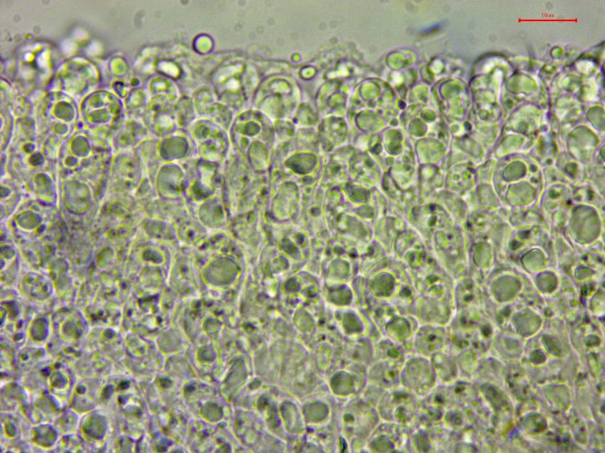 Lyophyllum brunneo ochrascens 16 Basidien grosse Oeltropfen tot oelreiche Strukturen Ockerbrauner Rasling Norwegen Innlandet Vaga Lusaeter Birke Schaf